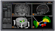 neuroinspire - planning screenshot (V4)